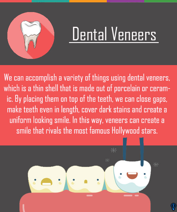 Dental Veneers and Dental Laminates Mission Viejo, CA