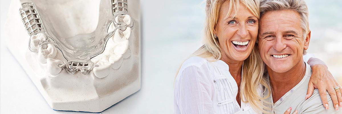 Mission Viejo Implant Supported Dentures