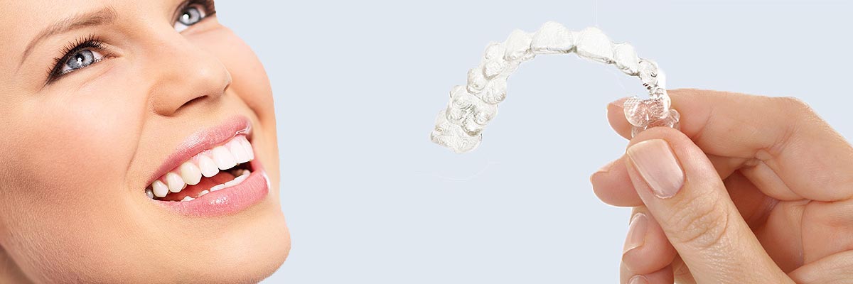 Mission Viejo 7 Things Parents Need to Know About Invisalign Teen