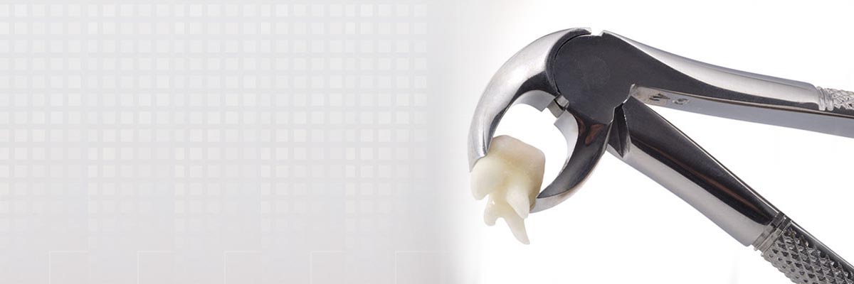 Mission Viejo Tooth Extraction