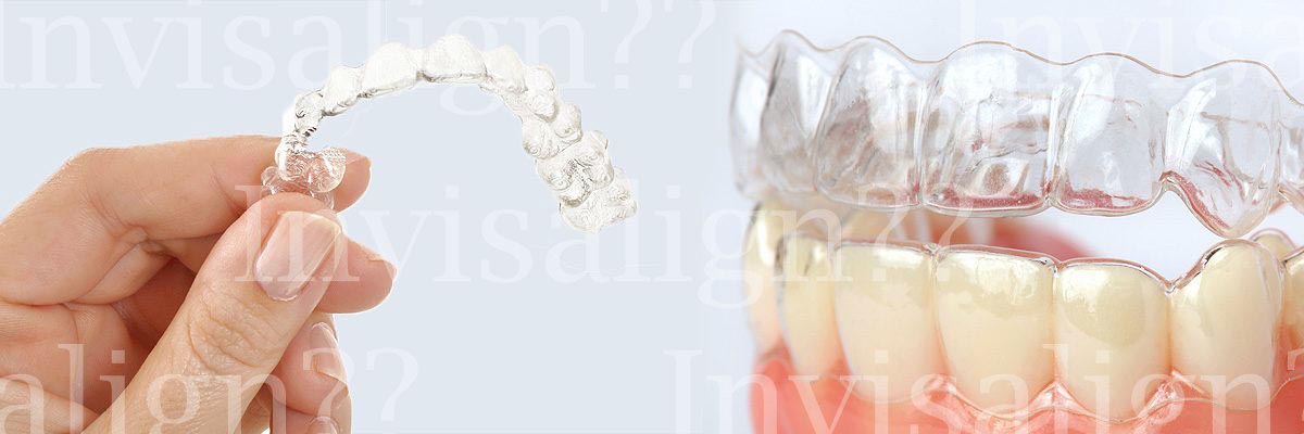 Mission Viejo Does Invisalign® Really Work?